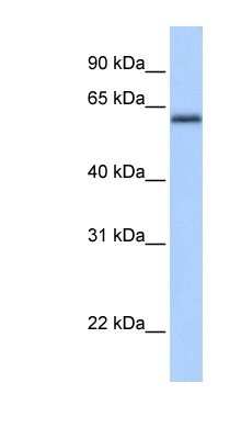 Western Blot: ZNF417 Antibody [NBP1-80160]