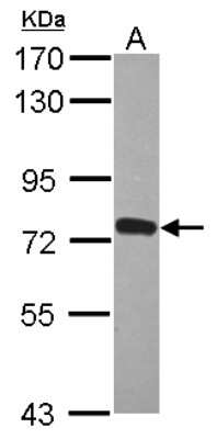 Western Blot: ZNF417 Antibody [NBP2-21011]