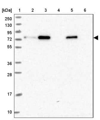 Western Blot: ZNF417 Antibody [NBP2-46668]