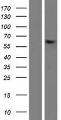Western Blot: ZNF417 Overexpression Lysate [NBP2-05365]