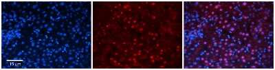Immunohistochemistry-Paraffin: ZNF419A Antibody [NBP3-10516]