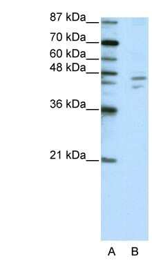 Western Blot: ZNF419A Antibody [NBP1-80366]
