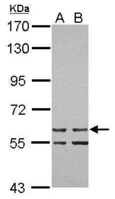 Western Blot: ZNF419A Antibody [NBP2-21013]