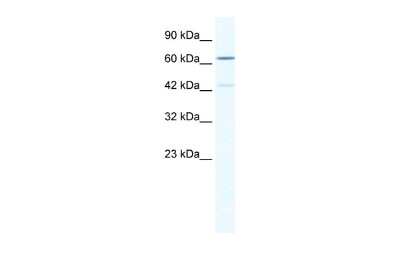 Western Blot: ZNF419A Antibody [NBP3-10386]