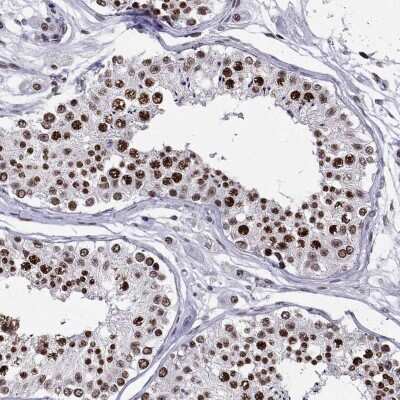 Immunohistochemistry-Paraffin: ZNF420 Antibody [NBP2-55984]