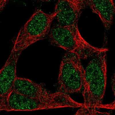 Immunocytochemistry/ Immunofluorescence: ZNF423 Antibody [NBP2-57466]