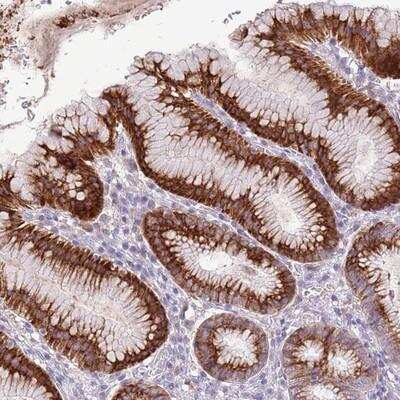 Immunohistochemistry: ZNF425 Antibody [NBP2-13572]