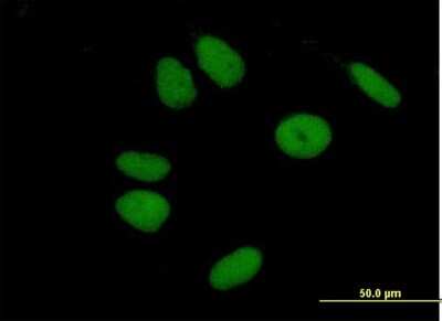 Immunocytochemistry/ Immunofluorescence: ZNF43 Antibody [H00007594-B01P]
