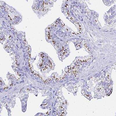 Immunohistochemistry-Paraffin: ZNF432 Antibody [NBP2-31813]