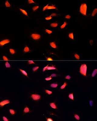 Immunocytochemistry/ Immunofluorescence: ZNF433 Antibody - Azide and BSA Free [NBP3-05110]