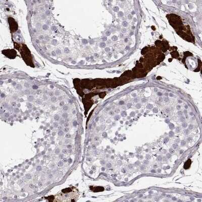 Immunohistochemistry-Paraffin: ZNF433 Antibody [NBP2-58010]