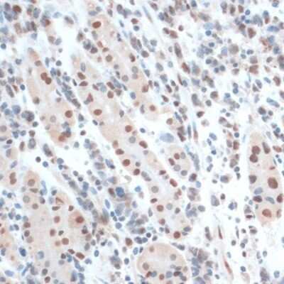 Immunohistochemistry-Paraffin: ZNF433 Antibody - Azide and BSA Free [NBP3-05110]