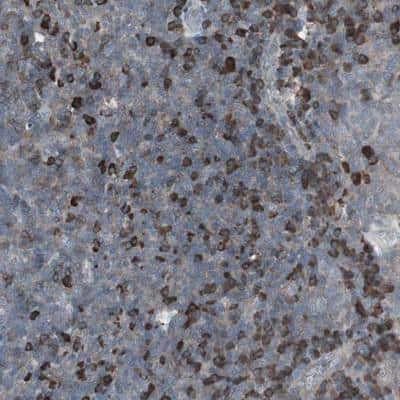 Immunohistochemistry-Paraffin: ZNF434 Antibody [NBP1-82182]