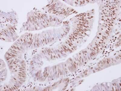 Immunohistochemistry-Paraffin: ZNF434 Antibody [NBP2-21016]