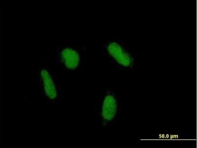 Immunocytochemistry/ Immunofluorescence: ZNF436 Antibody [H00080818-B01P]