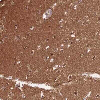 Immunohistochemistry-Paraffin: ZNF436 Antibody [NBP1-82897]