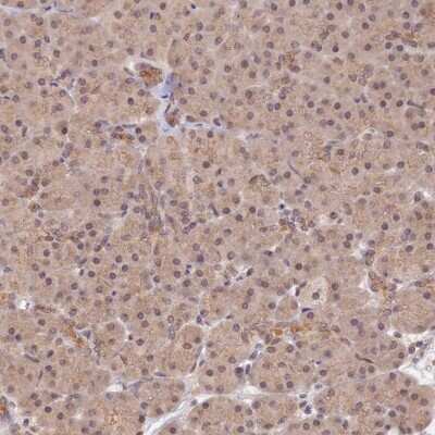 Immunohistochemistry-Paraffin: ZNF436 Antibody [NBP1-82897]