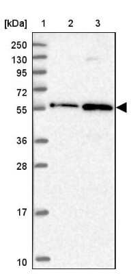 Western Blot: ZNF436 Antibody [NBP1-82897]