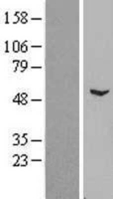 Western Blot: ZNF436 Overexpression Lysate [NBP2-09257]