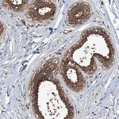 Immunohistochemistry-Paraffin: ZNF438 Antibody [NBP1-88797]