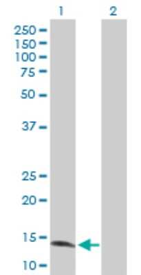 Western Blot: ZNF44 Antibody [H00051710-D01P]
