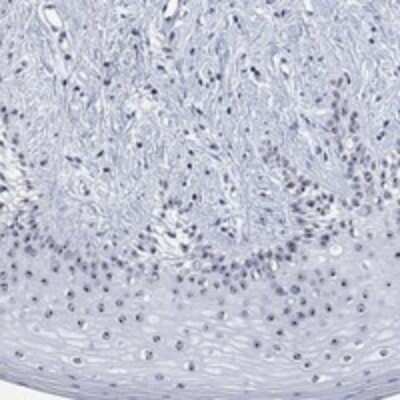 Immunohistochemistry-Paraffin: ZNF446 Antibody [NBP3-17968]