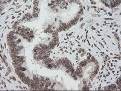 Immunohistochemistry: ZNF447 Antibody (OTI2H7) - Azide and BSA Free [NBP2-74951]