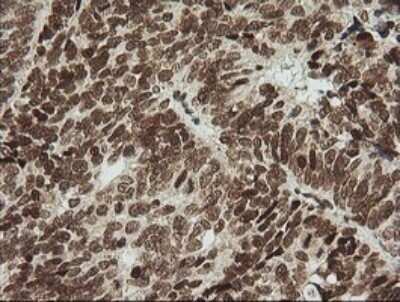 Immunohistochemistry: ZNF447 Antibody (OTI2H7) - Azide and BSA Free [NBP2-74951]