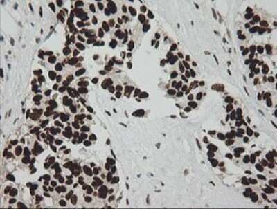 Immunohistochemistry: ZNF447 Antibody (OTI2H7) [NBP2-45442]