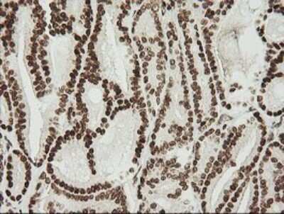 Immunohistochemistry: ZNF447 Antibody (OTI2H7) [NBP2-45442]