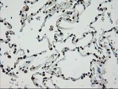 Immunohistochemistry: ZNF447 Antibody (OTI2H7) [NBP2-45442]