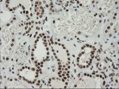 Immunohistochemistry: ZNF447 Antibody (OTI2H7) [NBP2-45442]