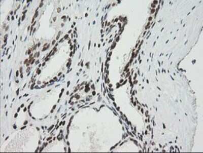 Immunohistochemistry: ZNF447 Antibody (OTI2H7) [NBP2-45442]