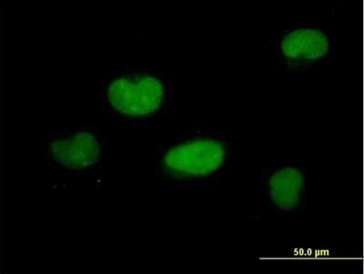 Immunocytochemistry/ Immunofluorescence: ZNF449 Antibody [H00203523-B01P]