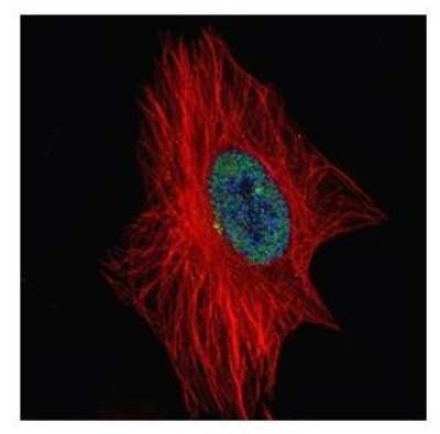 Immunocytochemistry/ Immunofluorescence: ZNF449 Antibody [NBP2-21019]