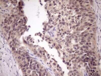Immunohistochemistry: ZNF449 Antibody (OTI4C6) - Azide and BSA Free [NBP2-74952]