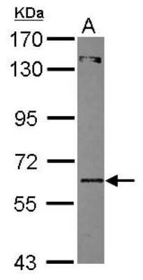 Western Blot: ZNF449 Antibody [NBP2-21019]