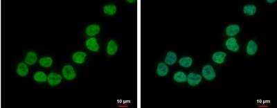 Immunocytochemistry/ Immunofluorescence: ZNF45 Antibody [NBP1-32382]