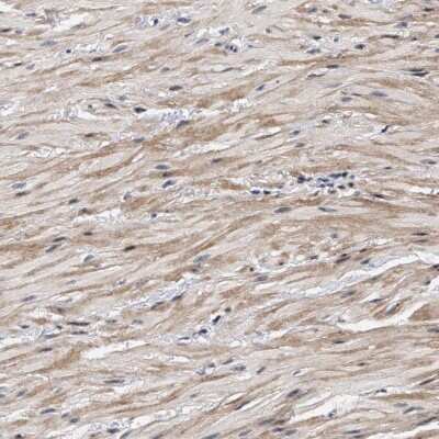 Immunohistochemistry-Paraffin: ZNF462 Antibody [NBP1-85021]