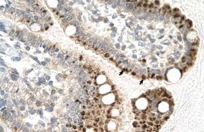 Immunohistochemistry-Paraffin: ZNF475 Antibody [NBP2-86497]