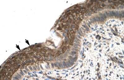 Immunohistochemistry-Paraffin: ZNF475 Antibody [NBP2-86497]