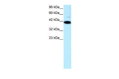 Western Blot: ZNF475 Antibody [NBP2-86497]
