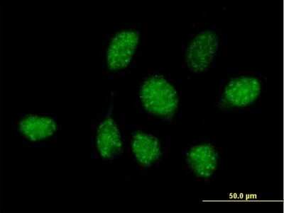 Immunocytochemistry/ Immunofluorescence: ZNF486 Antibody [H00090649-B01P]