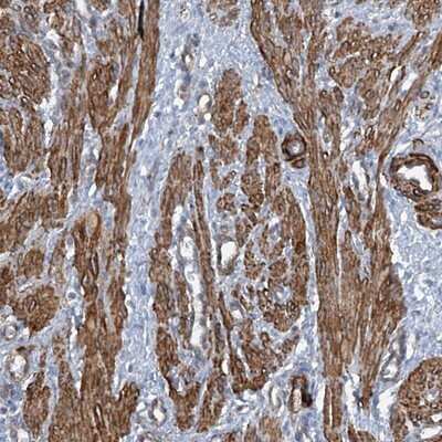 Immunohistochemistry-Paraffin: ZNF490 Antibody [NBP1-81432]