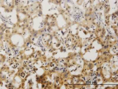Immunohistochemistry-Paraffin: ZNF496 Antibody (2B3) [H00084838-M08]