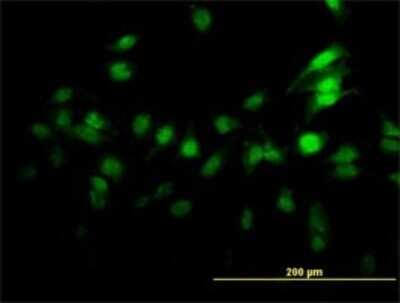 Immunocytochemistry/ Immunofluorescence: ZNF496 Antibody (4B1) [H00084838-M02]