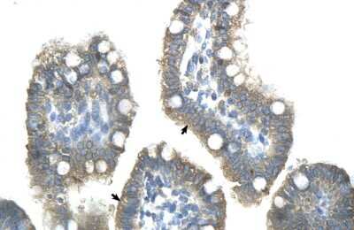 Immunohistochemistry: ZNF498 Antibody [NBP2-86504]