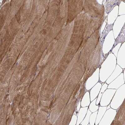Immunohistochemistry-Paraffin: ZNF498 Antibody [NBP2-33738]
