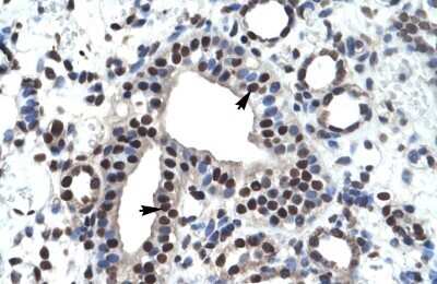 Immunohistochemistry-Paraffin: ZNF499 Antibody [NBP1-79965]