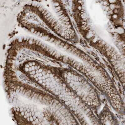 Immunohistochemistry-Paraffin: ZNF499 Antibody [NBP1-92627]